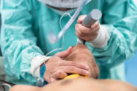 Advanced Airway Management: What You Need to Know