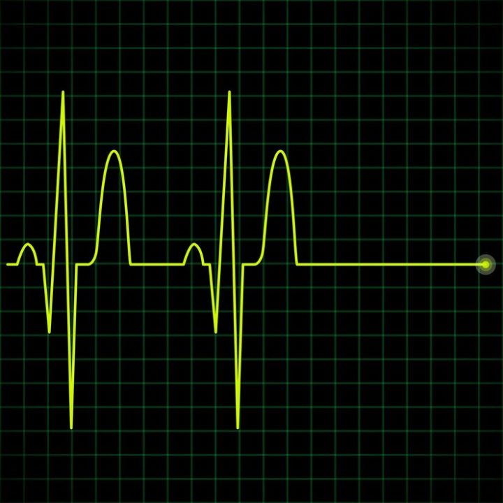 How to Understand ACLS Rhythms If You’re Not Great at EKGs